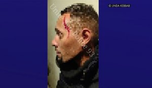 Pantin : arrêté pour exhibition, il agresse deux policiers