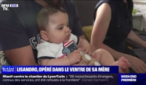 Lisandro sauvé d'un anévrisme grâce à une opération réalisée dans le ventre de sa mère