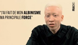 À Voix Haute - Charles Edouard, l'albinisme