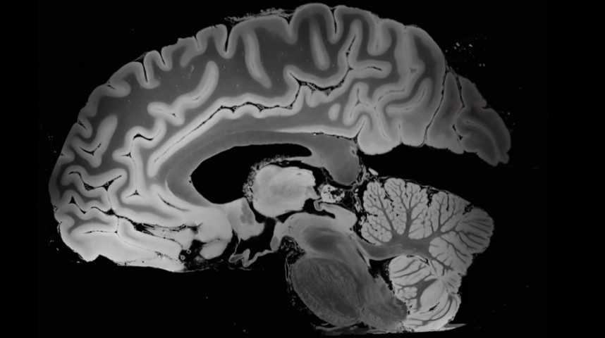 The Brain - Cinq nouvelles du cerveau - Bande annonce 1 - VF - (2021)