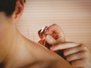 10 choses à savoir sur l'acupuncture