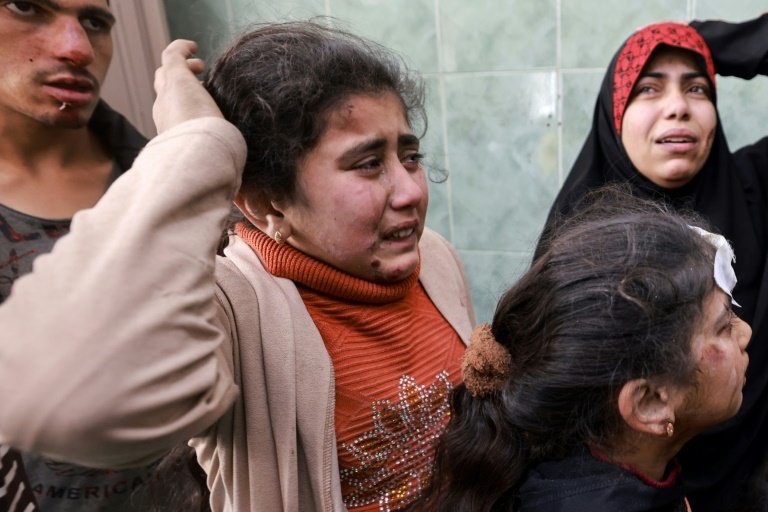 Des enfants blessés dans un bombardement israélien à l'hôpital de Rafah dans le sud de la bande de Gaza le 1er mars 2024