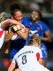 Coupe du Monde (F) : Le protège-dents connecté évolue pour mieux détecter les commotions cérébrales 