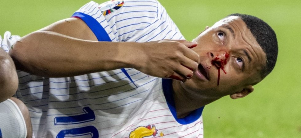 Bleus : Fracture du nez pour Mbappé 