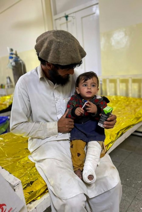 Un enfant afghan soigné dans un hôpital dans la ville de Sharan après avoir été blessé dans le séisme qui a frappé le sud-est de l'Afghanistan, le 22 juin 2022